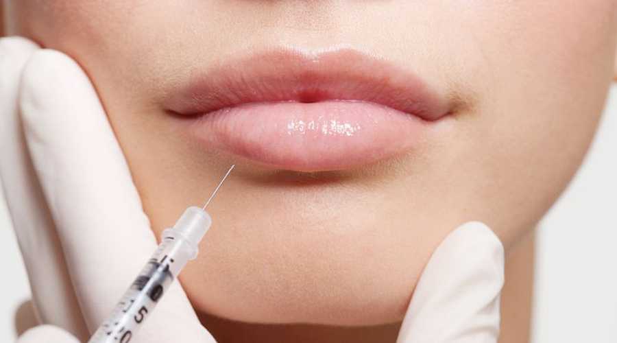 Увеличение губ гиалуроновой кислотой: подготовка к процедуре, противопоказания
