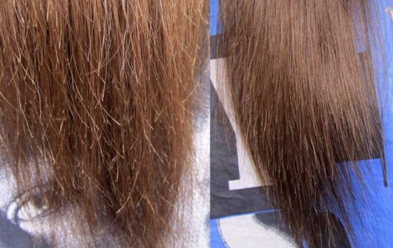 Выпадение волос при климаксе — что делать?