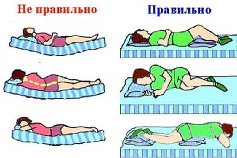 Как правильно спать при шейном остеохондрозе?