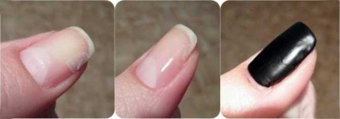 Трескается гель лак на ногтях: причины