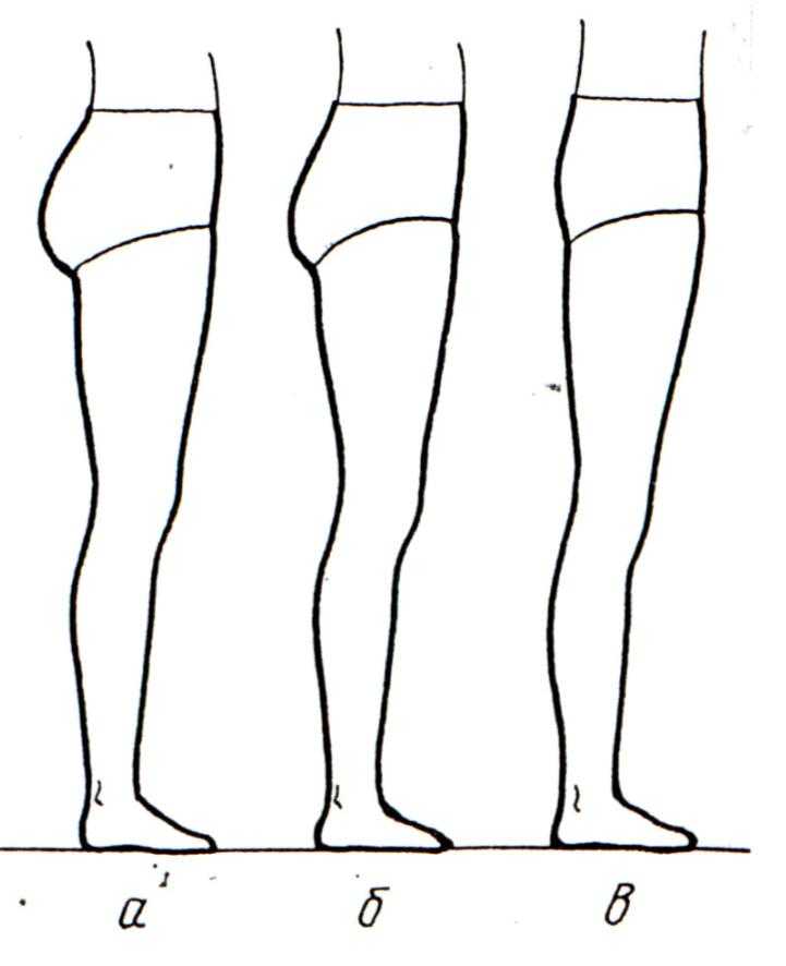 Какая часть тела увеличивается. Типы строения ног. Разное строение ног у девушек. Формы нижней части туловища.