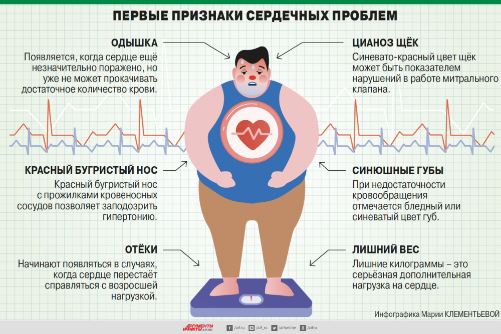 Лишний вес и малоподвижный образ жизни как факторы риска в возникновении ссз