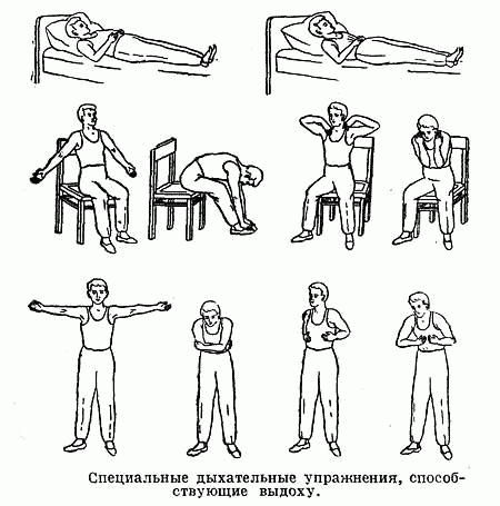 Дыхательная гимнастика стрельниковой упражнения в картинках после пневмонии