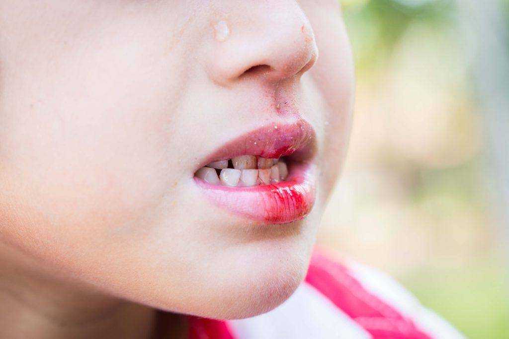 Почему поджимают губы. почему человек кусает губы психология. как научиться читать по губам: основные мимические показатели
