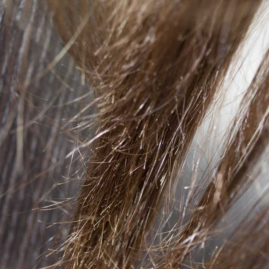 Почему сильно выпадают волосы и что с этим делать