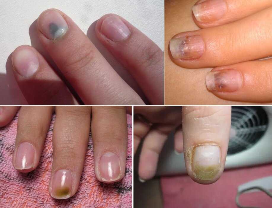 Вред гель-лака для ногтей: чем опасен для здоровья организма – безопасные для маникюра