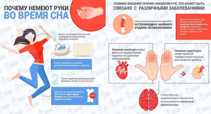 Онемела и не проходит. Болит правая сторона и немеет рука. Левая сторона туловища немеет. Немеет вся левая сторона тела причины.