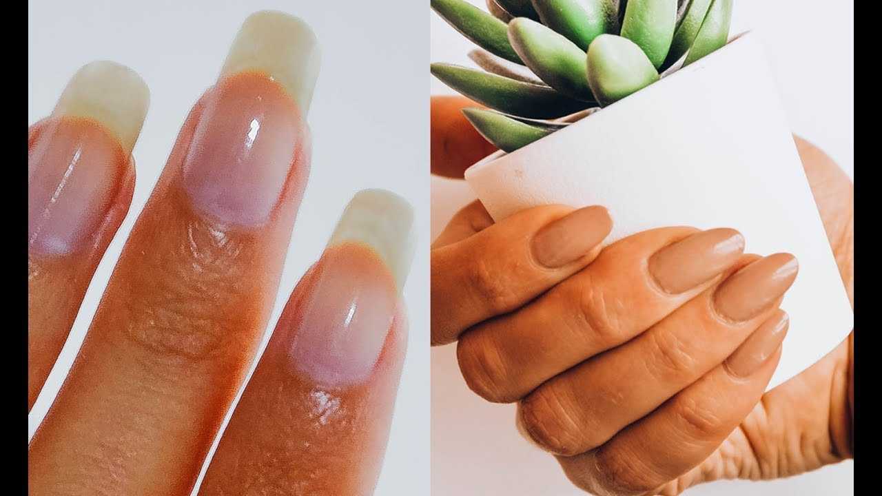 5 секретов, которые помогут отрастить ногти за неделю