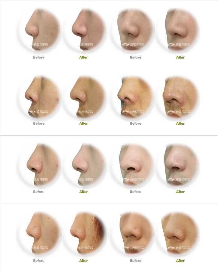 Почему нос назвали носом. Типы Носов курносый. Типы Носов у мужчин и их название. Формы Носов у детей. Типы Носов и их названия.