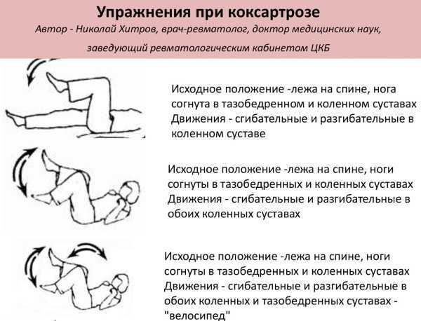 Упражнения для тазобедренных суставов: домашний комплекс