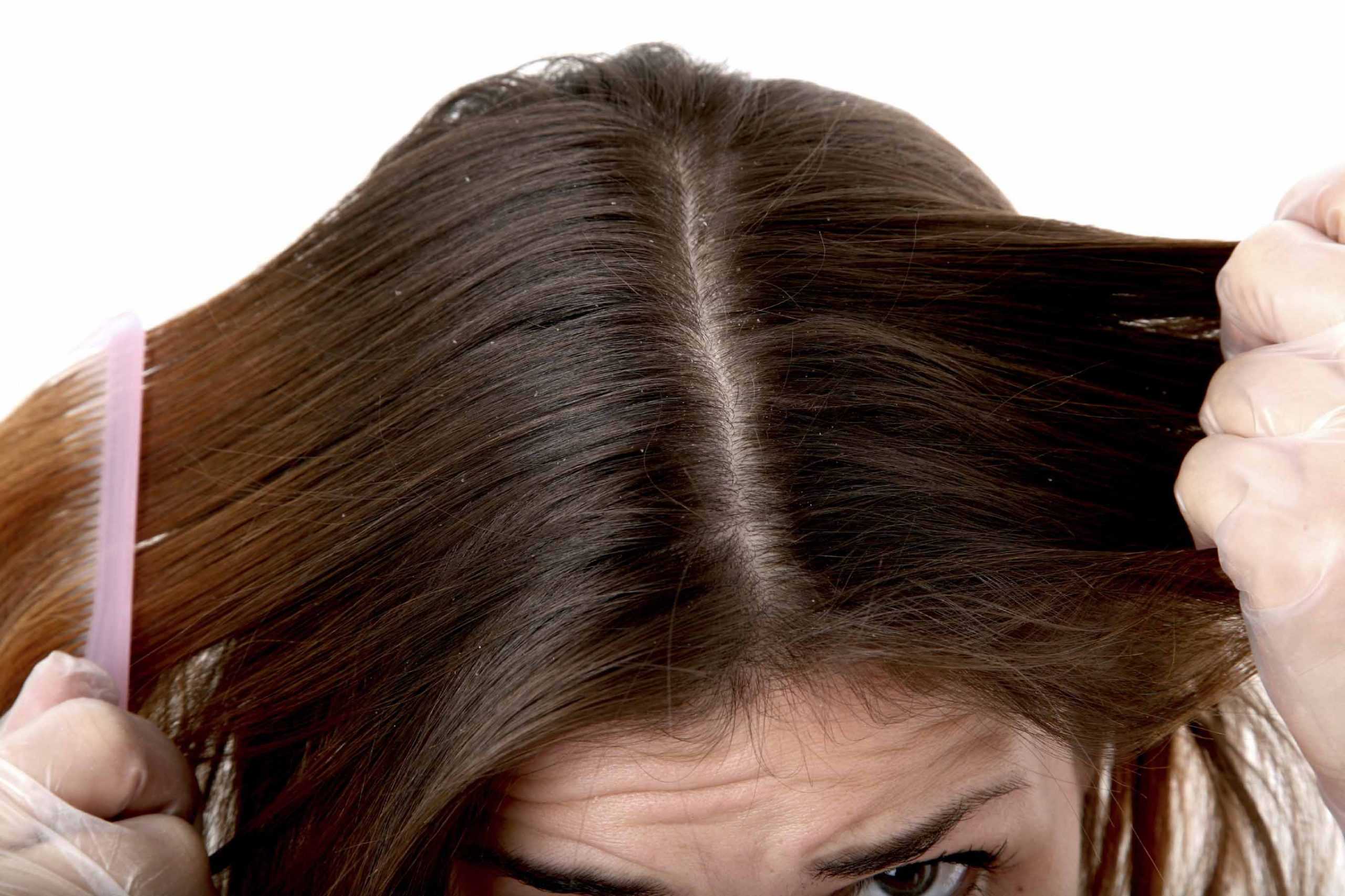 Плохое состояние волос и кожи что делать